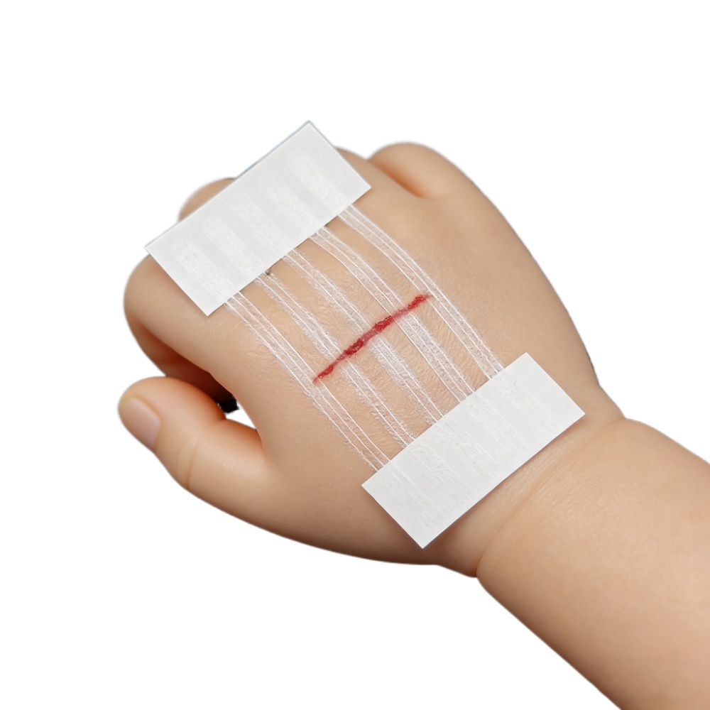 Medical Label - 5 Strip Perekat Penutup Luka untuk