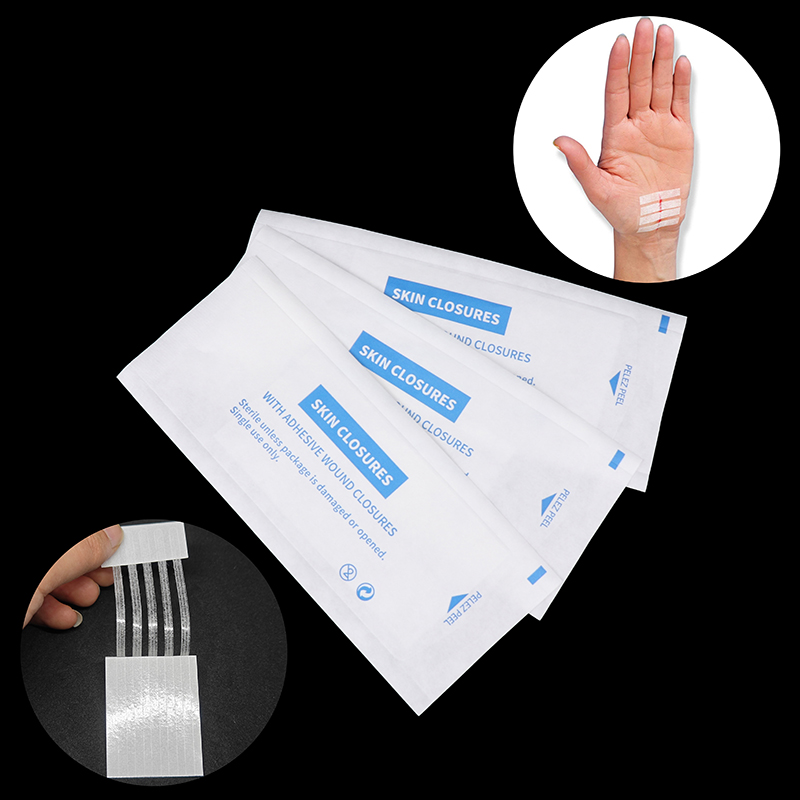 Medical Label - Strip steril penghilang bekas jerawat, perekat