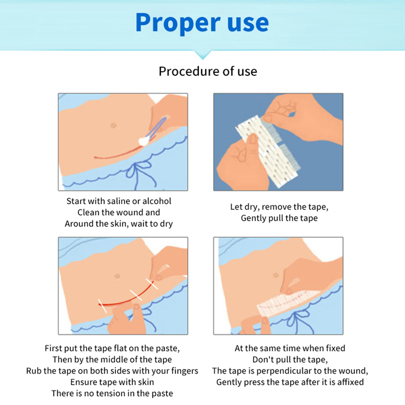 5 Strip Perekat Penutup Luka u - Medical Label ulasan dan harga